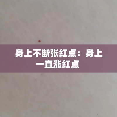 身上不断张红点:身上一直涨红点
