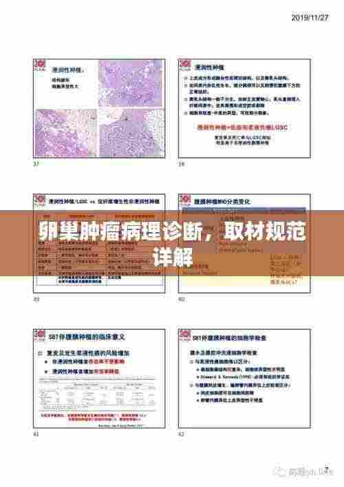 卵巢肿瘤病理诊断，取材规范详解